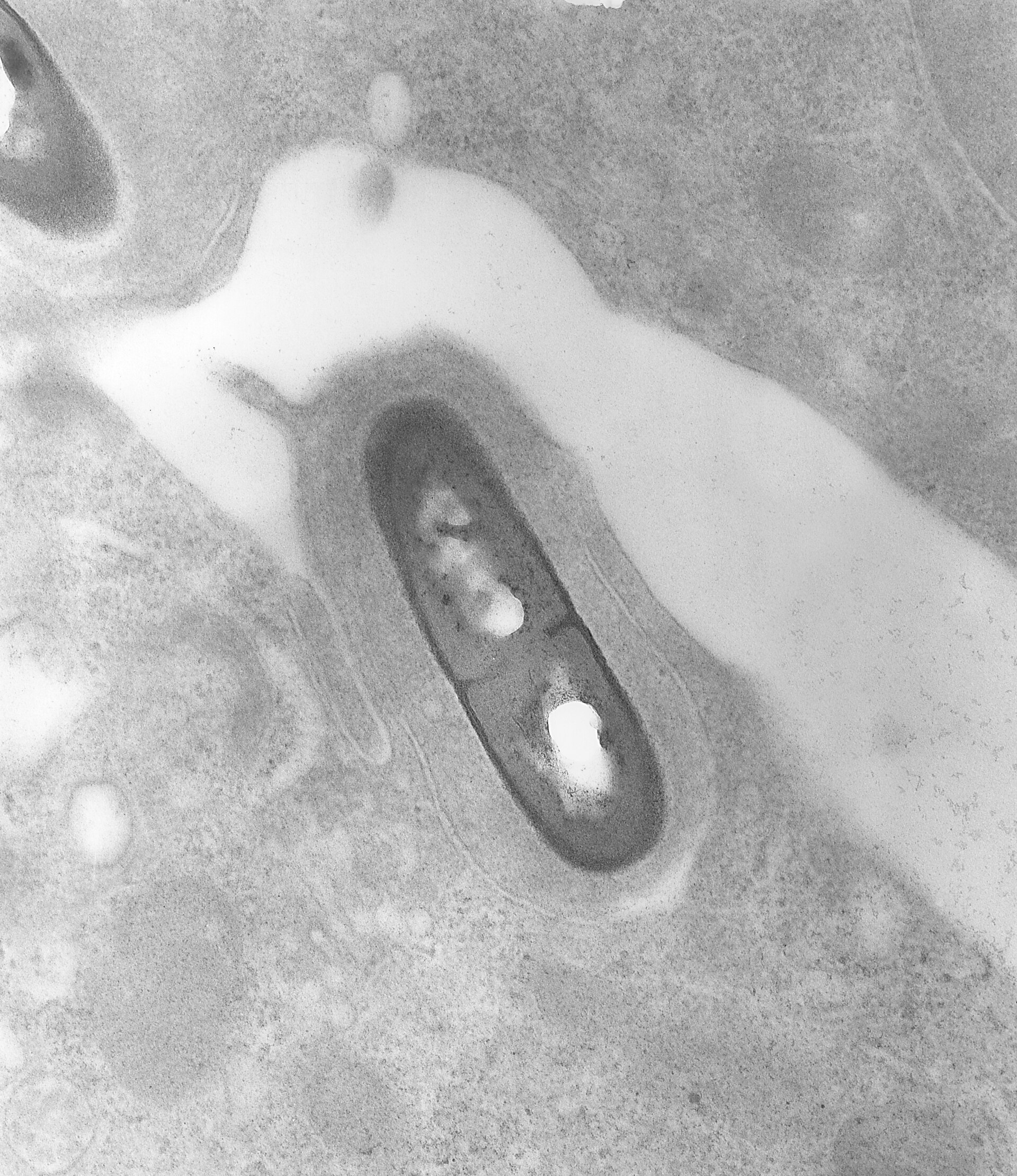electron micrograph of Listeria bacteria